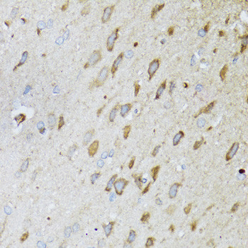 MT-ND5 Antibody in Immunohistochemistry (Paraffin) (IHC (P))