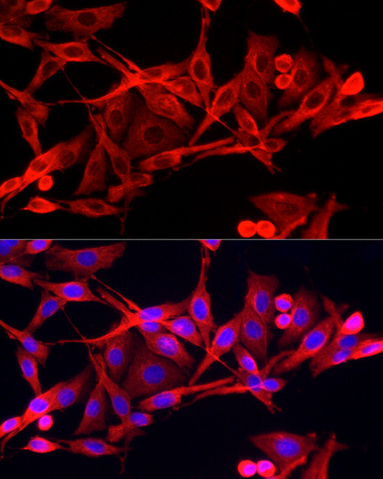 IFI44 Antibody in Immunocytochemistry (ICC/IF)