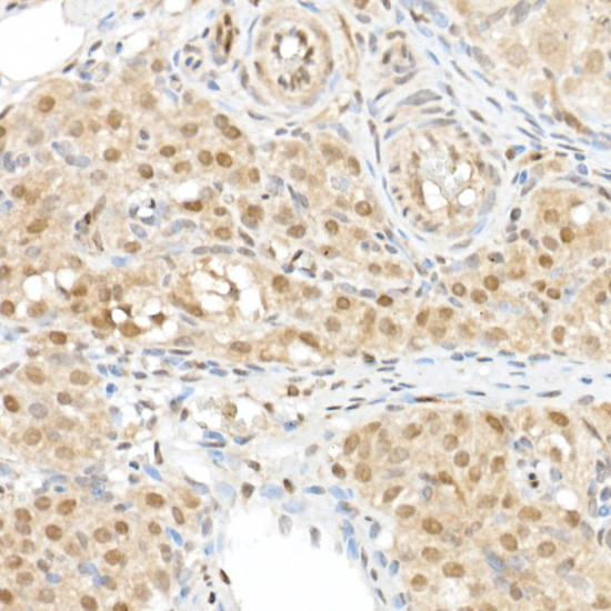 WWTR1 Antibody in Immunohistochemistry (Paraffin) (IHC (P))