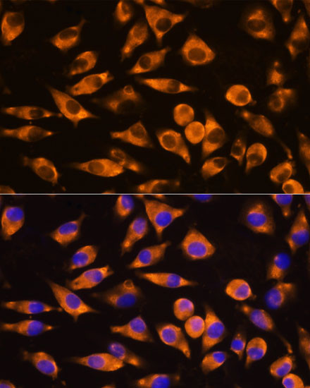 CEP55 Antibody in Immunocytochemistry (ICC/IF)