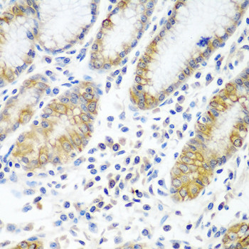 ATAD3A Antibody in Immunohistochemistry (Paraffin) (IHC (P))