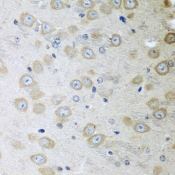 ATAD3A Antibody in Immunohistochemistry (Paraffin) (IHC (P))