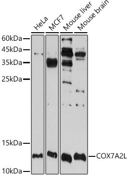 COX7A2L Antibody in Western Blot (WB)