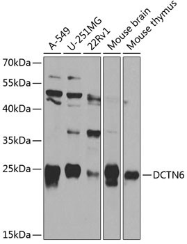 DCTN6 Antibody in Western Blot (WB)