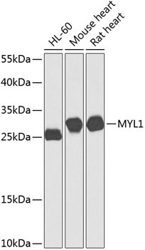 MYL1 Antibody in Western Blot (WB)