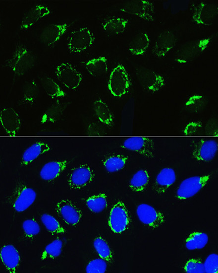 PTCD3 Antibody in Immunocytochemistry (ICC/IF)