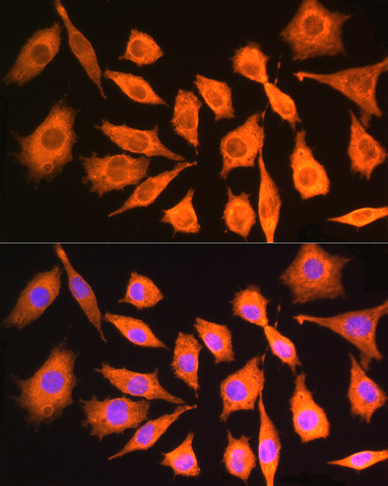 CKAP5 Antibody in Immunocytochemistry (ICC/IF)