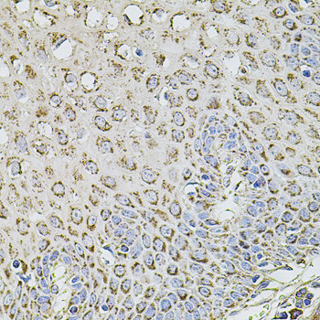 TMC1 Antibody in Immunohistochemistry (Paraffin) (IHC (P))