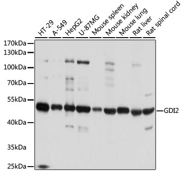 GDI2 Antibody in Western Blot (WB)