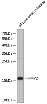 FABP8 Antibody in Western Blot (WB)