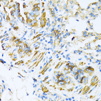 VAMP1 Antibody in Immunohistochemistry (Paraffin) (IHC (P))