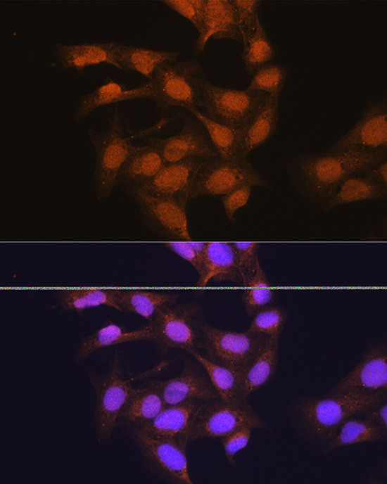 RPSA Antibody in Immunocytochemistry (ICC/IF)