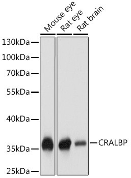 CRALBP Antibody in Western Blot (WB)