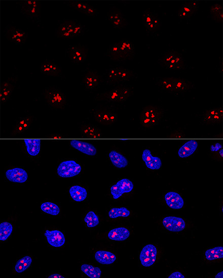 EBNA1BP2 Antibody in Immunocytochemistry (ICC/IF)