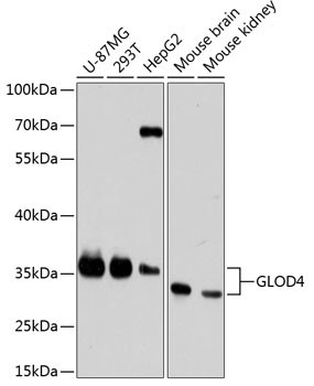 C17orf25 Antibody in Western Blot (WB)