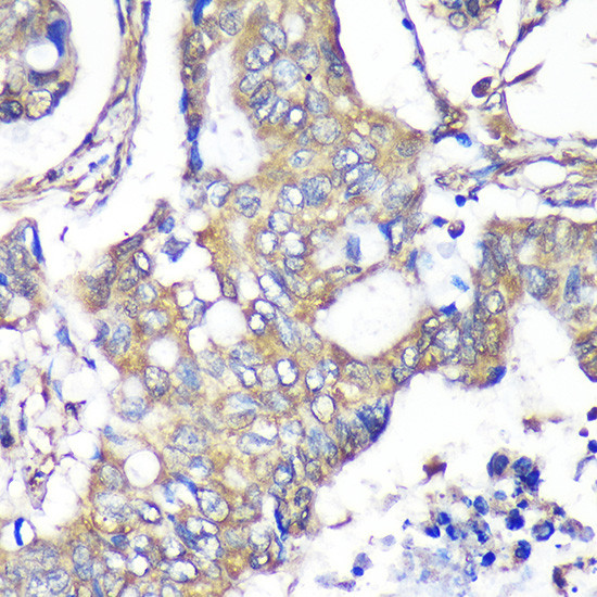 TXNDC9 Antibody in Immunohistochemistry (Paraffin) (IHC (P))