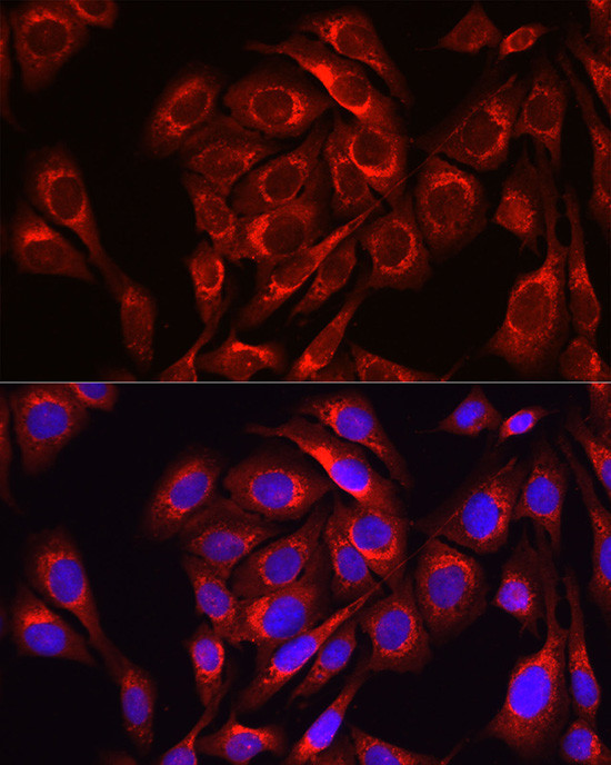 MFN1 Antibody in Immunocytochemistry (ICC/IF)