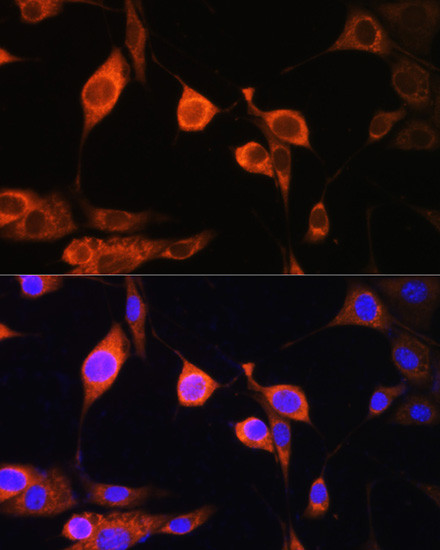 ATP5D Antibody in Immunocytochemistry (ICC/IF)