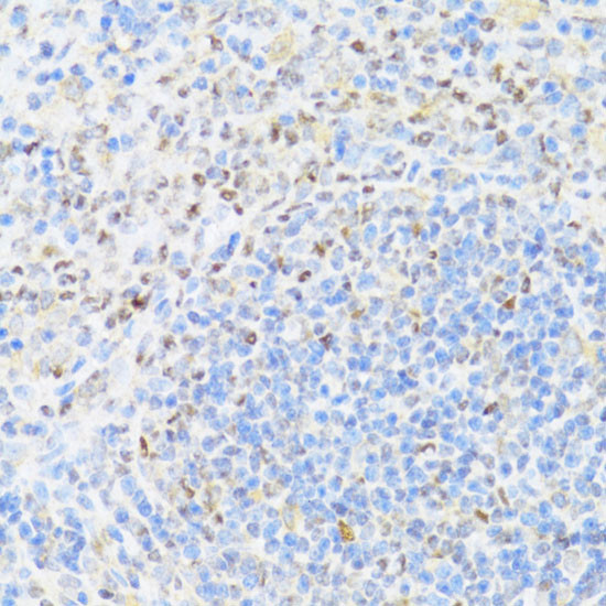 MNF1 Antibody in Immunohistochemistry (Paraffin) (IHC (P))