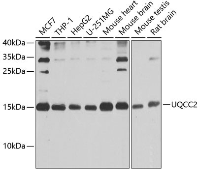 MNF1 Antibody in Western Blot (WB)