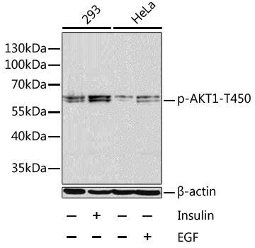 Phospho-AKT1 (Thr450) Antibody in Western Blot (WB)