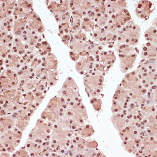 Phospho-ATF (Thr71) Antibody in Immunohistochemistry (Paraffin) (IHC (P))