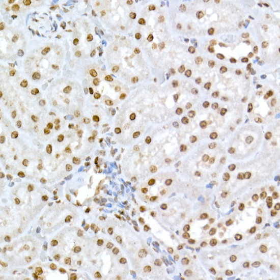 Phospho-Rb (Ser795) Antibody in Immunohistochemistry (Paraffin) (IHC (P))