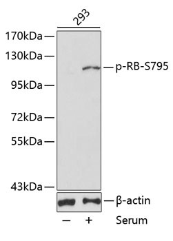 Phospho-Rb (Ser795) Antibody in Western Blot (WB)