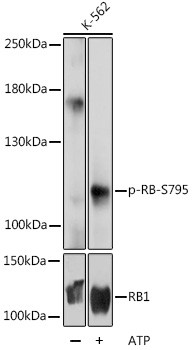 Phospho-Rb (Ser795) Antibody in Western Blot (WB)