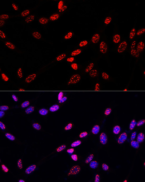 Phospho-Histone H3 (Thr11) Antibody in Immunocytochemistry (ICC/IF)