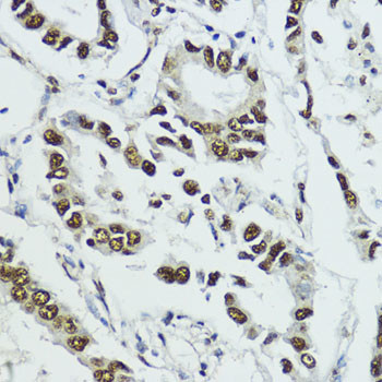 Phospho-Histone H3 (Thr11) Antibody in Immunohistochemistry (Paraffin) (IHC (P))