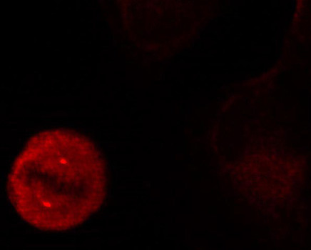 Phospho-ERK1 (Tyr204) Antibody in Immunocytochemistry (ICC/IF)