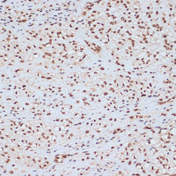 Phospho-ERK1 (Tyr204) Antibody in Immunohistochemistry (Paraffin) (IHC (P))