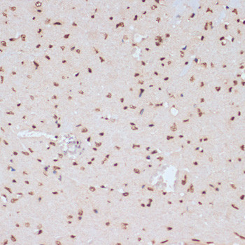 Phospho-ERK1 (Tyr204) Antibody in Immunohistochemistry (Paraffin) (IHC (P))