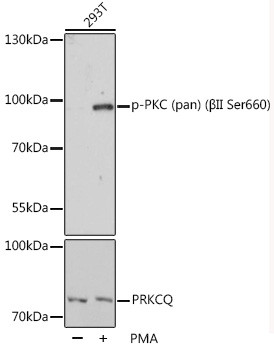 Phospho-PKC Pan (Ser660) Antibody in Western Blot (WB)