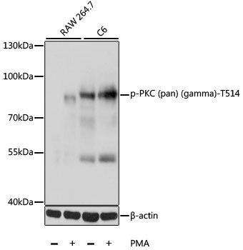 Phospho-PKC Pan (Thr514) Antibody in Western Blot (WB)