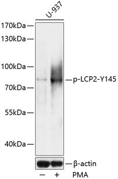 Phospho-SLP76 (Tyr145) Antibody in Western Blot (WB)