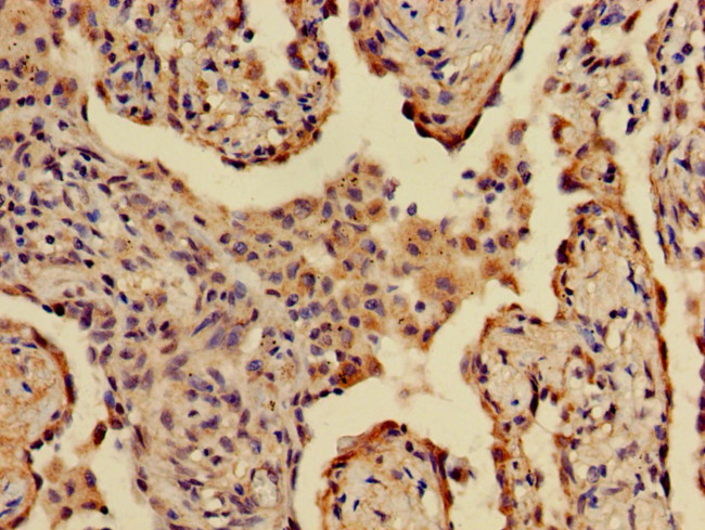 A2ML1 Antibody in Immunohistochemistry (Paraffin) (IHC (P))