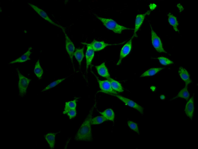 AGPS Antibody in Immunocytochemistry (ICC/IF)