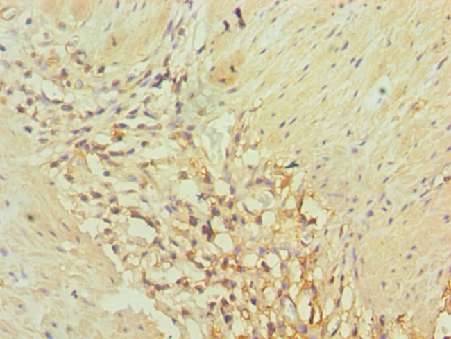 AKR1C3 Antibody in Immunohistochemistry (Paraffin) (IHC (P))