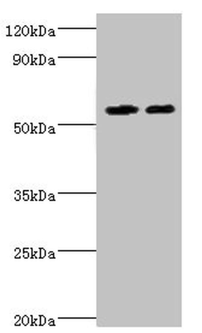 ALDH4A1 Antibody in Western Blot (WB)