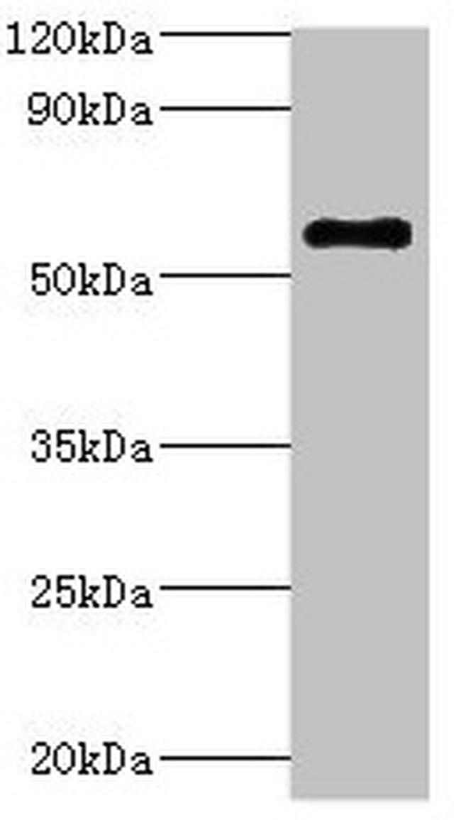 ATP6V1B2 Antibody in Western Blot (WB)