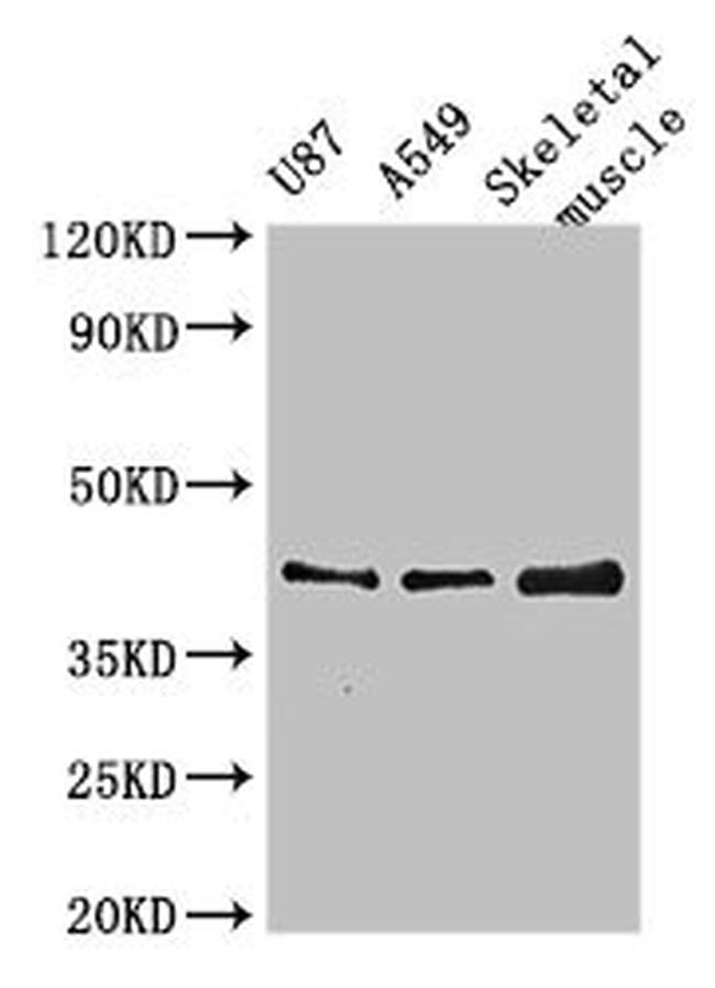B3GALT4 Antibody in Western Blot (WB)
