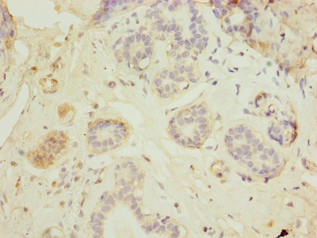 HEATR9 Antibody in Immunohistochemistry (Paraffin) (IHC (P))