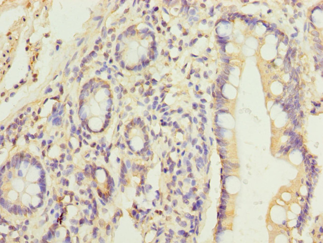 HEATR9 Antibody in Immunohistochemistry (Paraffin) (IHC (P))