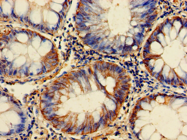 GPI Antibody in Immunohistochemistry (Paraffin) (IHC (P))