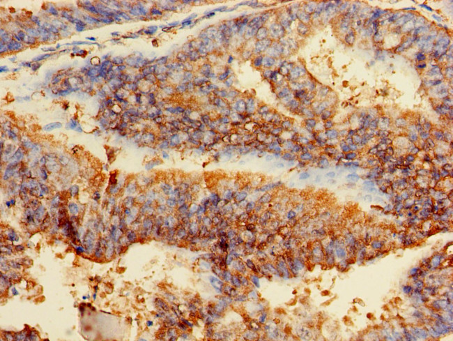 GPI Antibody in Immunohistochemistry (Paraffin) (IHC (P))