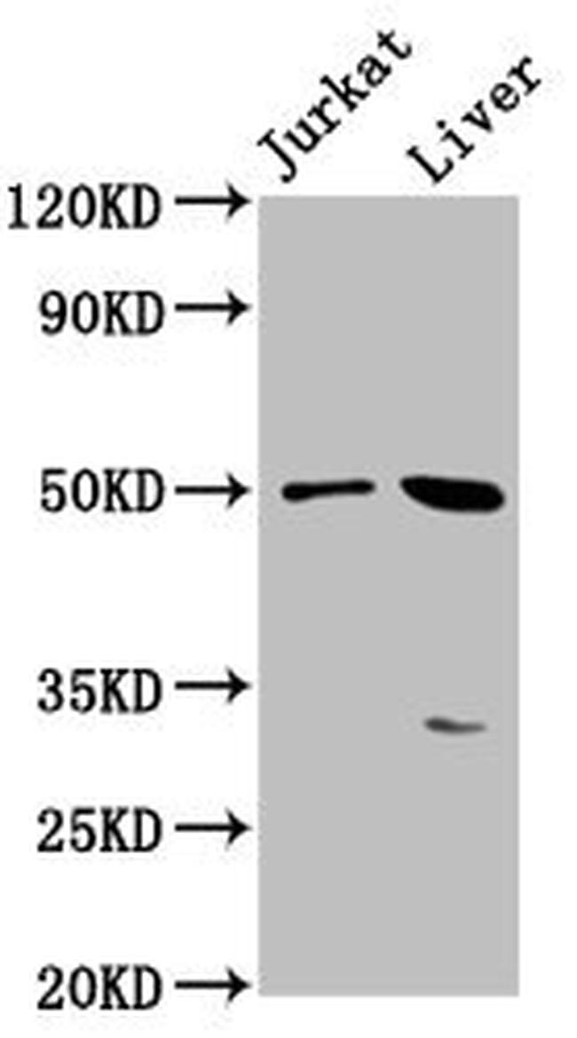 BPIFB3 Antibody in Western Blot (WB)