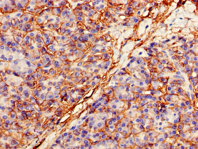 Carbonic Anhydrase XII Antibody in Immunohistochemistry (Paraffin) (IHC (P))