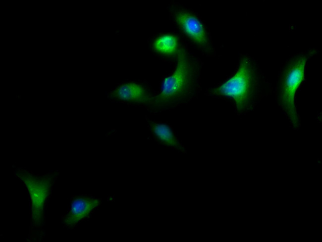 CAP1 Antibody in Immunocytochemistry (ICC/IF)